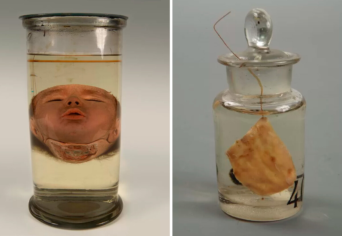 俄罗斯科学院彼得大帝人类学与民族学博物馆